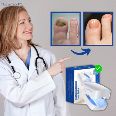 LumiNagel™ Zehennagel-Lasergerät | Werden Sie Nagelpilz in nur 7 Tagen los