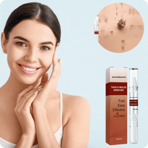DermaRemove™ Pen sagen | Entfernt Warzen und Hautunreinheiten schmerzlos in 3 Tagen!