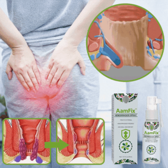 AamFix™ Hämorrhoiden-Spray | Entfernen und verhindern Sie schmerzhafte Hämorrhoiden mit 1 Sprühstoß