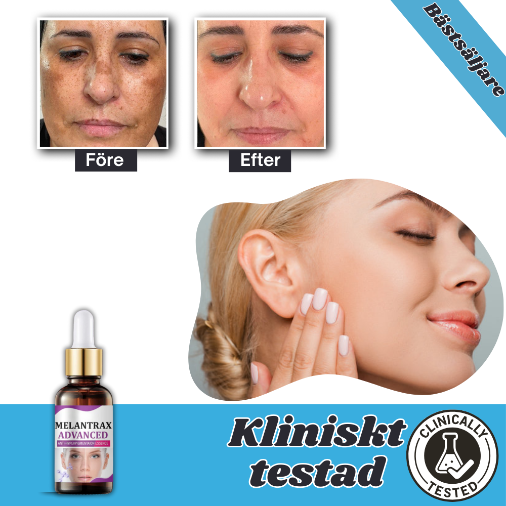 GlowEven™ – Serum | Lässt dunkle Flecken und Pigmentflecken in 14 Tagen verblassen