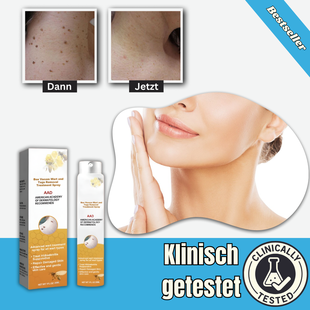 SkinClear™ - Spray | Entfernt Warzen und Hautflecken in 1-3 Wochen