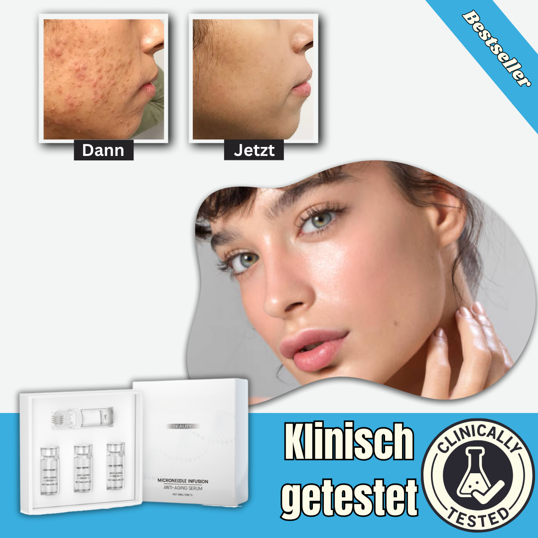ScarErase™ - Serum | Reduziert Aknenarben in 14 Tagen um 97 %