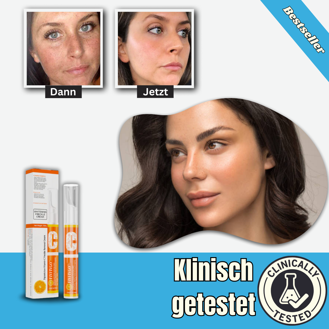 GlowSkin™ - Creme | Entfernt Sommersprossen und dunkle Flecken in 7 Tagen