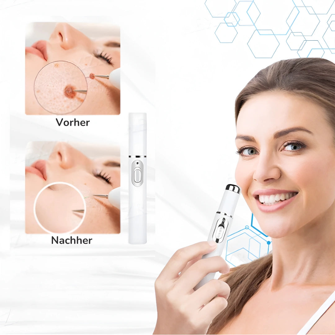 LaserPen™ sagen | Entfernt Warzen und Muttermale in 2 Tagen!