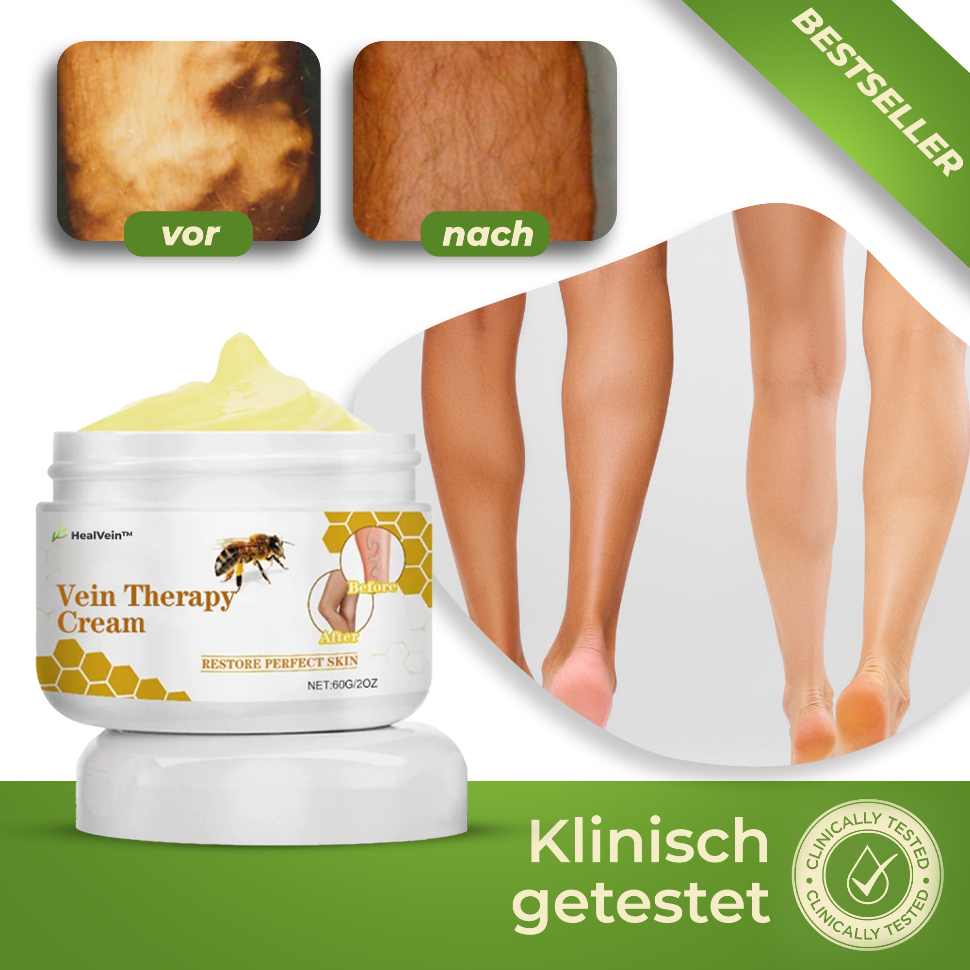 HealVein™ – Creme | Reduziert Krampfadern um 85 % in nur 4 Wochen