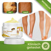 HealVein™ – Creme | Reduziert Krampfadern um 85 % in nur 4 Wochen