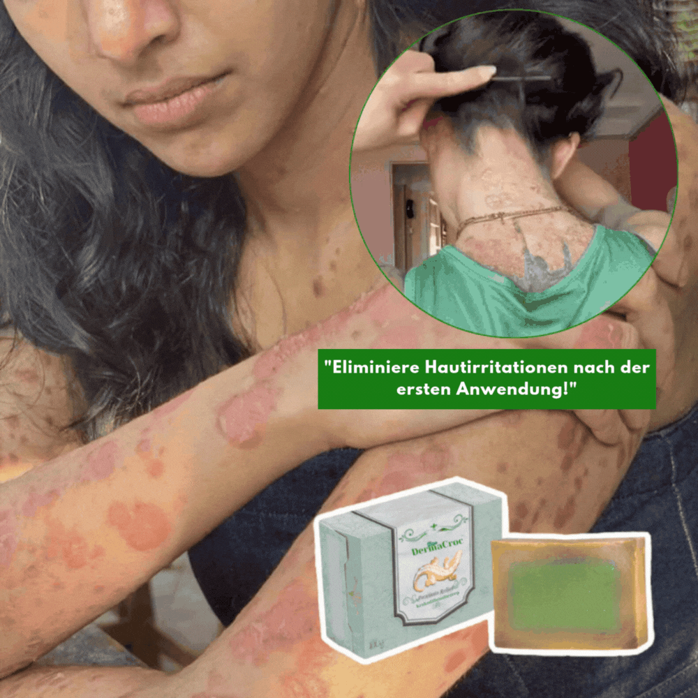 DermaCroc™ Krokodilölseife | Beseitigt Ekzeme und Schuppenflechte in 48 Stunden