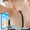 VitaGlow™ - Vitiligo lindernde Salbe | 1+1 gratis