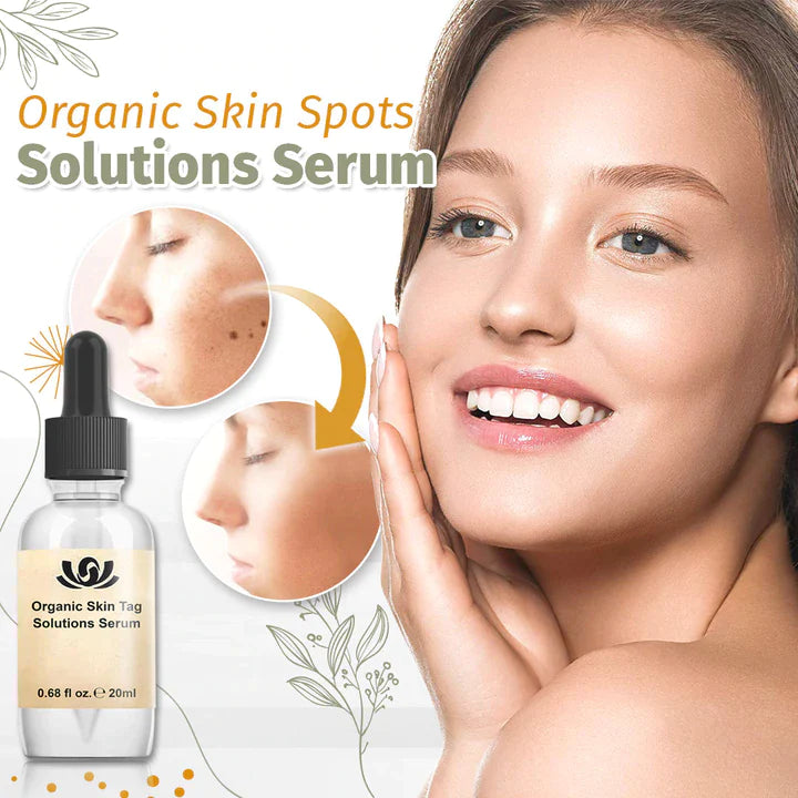 SpotVrij™ - Bio-Lösung für Hautflecken Serum